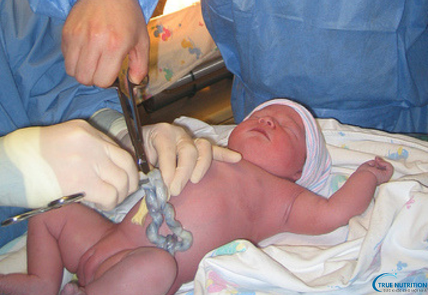 Bệnh U Hạt Rốn: Những Điều Cần Biết Và Phương Pháp Xử Lý An Toàn