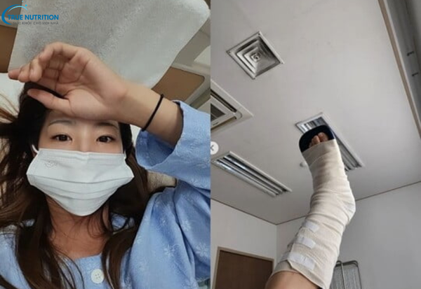 Biến Chứng Bó Bột: Hướng Dẫn Chăm Sóc Để Tránh Rủi Ro Sức Khỏe