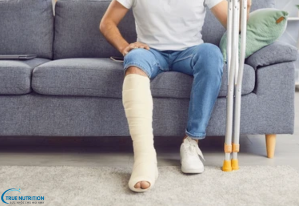 Biến Chứng Bó Bột: Hướng Dẫn Chăm Sóc Để Tránh Rủi Ro Sức Khỏe