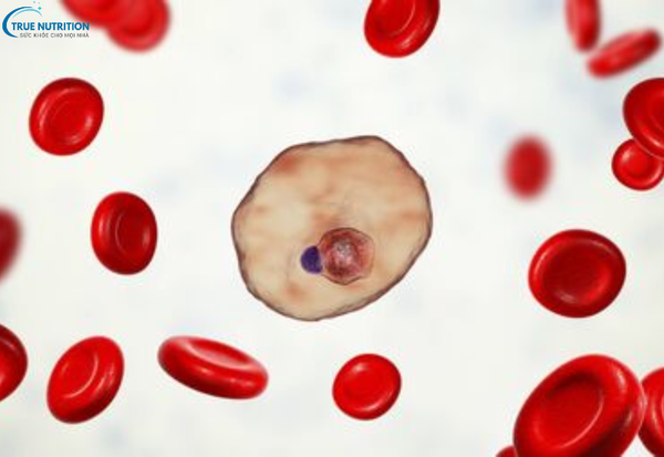 Bệnh Huyết Tán Tự Miễn: Nguyên Nhân, Triệu Chứng Và Cách Điều Trị