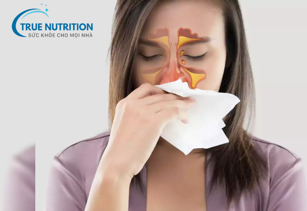 Bệnh Viêm Xoang Mũi – Nguyên Nhân, Triệu Chứng và Cách Điều Trị