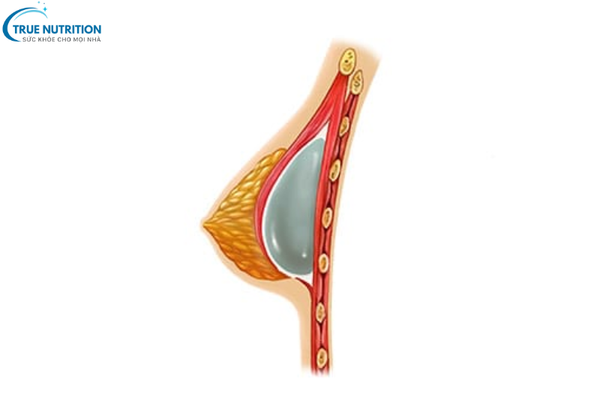 Nâng Ngực - Bí Quyết Thăng Hạng Nhan Sắc Phái Đẹp Hiện Đại