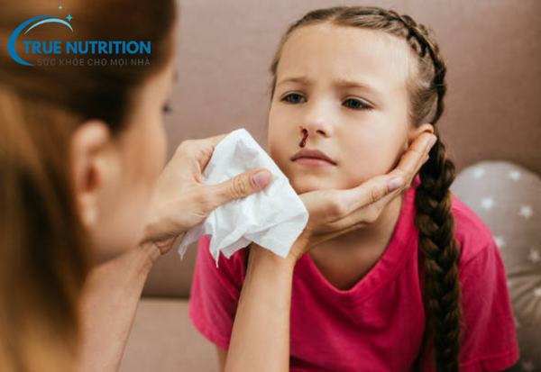 Chảy Máu Cam: Nguyên Nhân, Phân Loại Và Phòng Ngừa