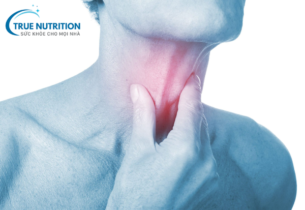Bệnh Viêm Họng: Dấu Hiệu Nhận Biết Và Cách Điều Trị Hiệu Quả