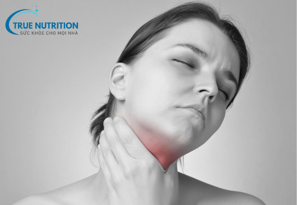 Bệnh Viêm Họng: Dấu Hiệu Nhận Biết Và Cách Điều Trị Hiệu Quả