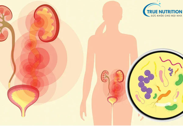 Nhiễm Trùng Đường Tiết Niệu: Cảnh Báo Triệu Chứng&nbsp; Và Cách Phòng Ngừa