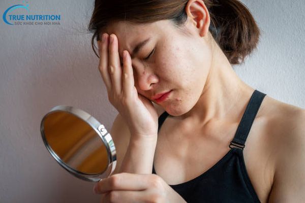 Nổi mụn nhiều có phải bệnh gan không?