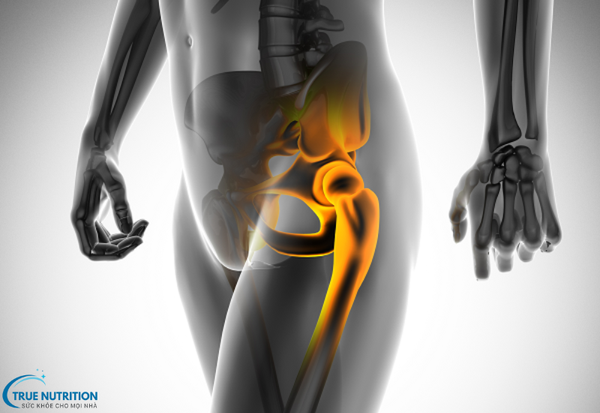 Phẫu Thuật Gãy Xương: Giải Pháp Tối Ưu Cho Việc Hồi Phục Nhanh Chóng