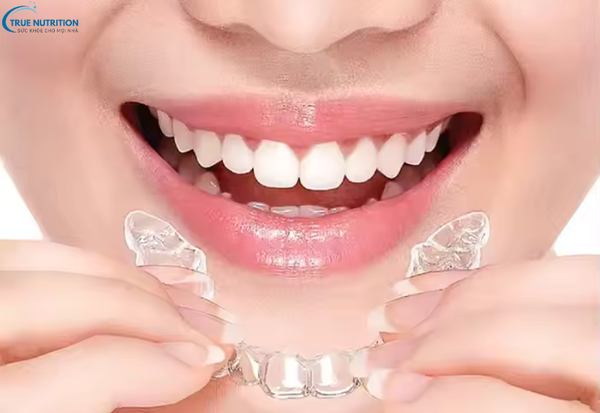 Cách Trị Răng Xỉn Màu: Bí Quyết Cho Nụ Cười Trắng Sáng Suốt Cả Ngày