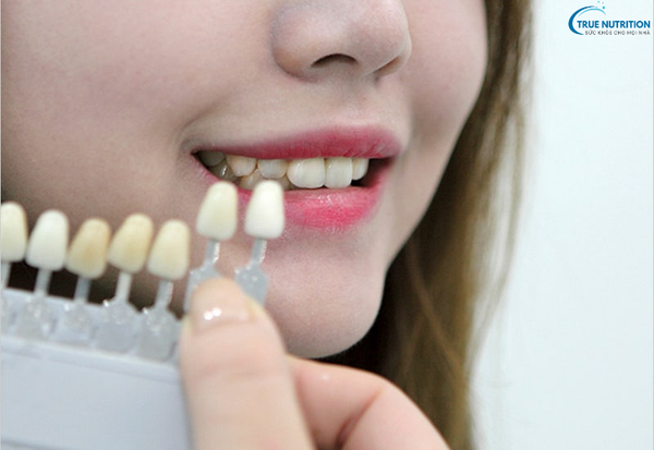 Cách Trị Răng Xỉn Màu: Bí Quyết Cho Nụ Cười Trắng Sáng Suốt Cả Ngày