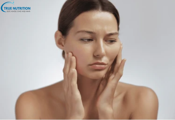 Bệnh Sạm Da Là Gì? Nguyên Nhân, Biểu Hiện và Cách Khắc Phục Hiệu Quả