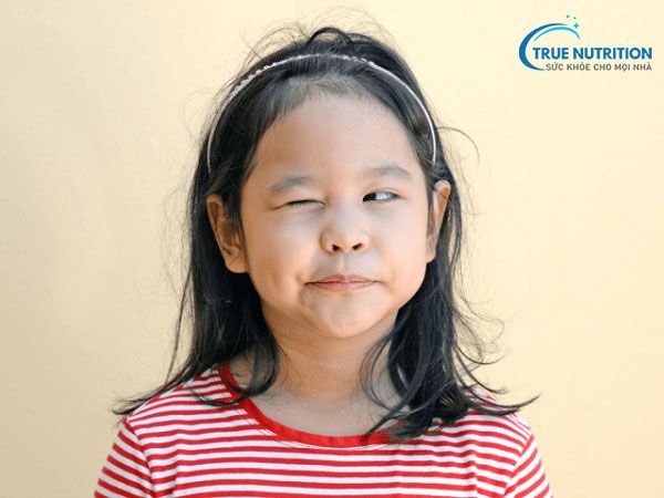 Cách Điều Trị Nháy Mắt ở Trẻ Nhỏ: Nguyên Nhân, Phòng Ngừa