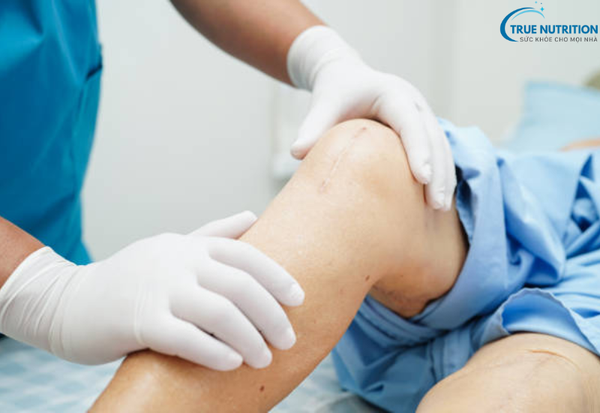 Thay Khớp Gối: Giải Pháp Đột Phá Giúp Khôi Phục Sức Khỏe và Cuộc Sống