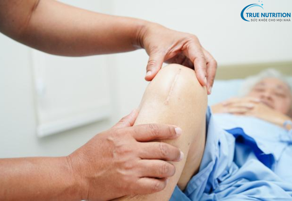 Thay Khớp Gối: Giải Pháp Đột Phá Giúp Khôi Phục Sức Khỏe và Cuộc Sống