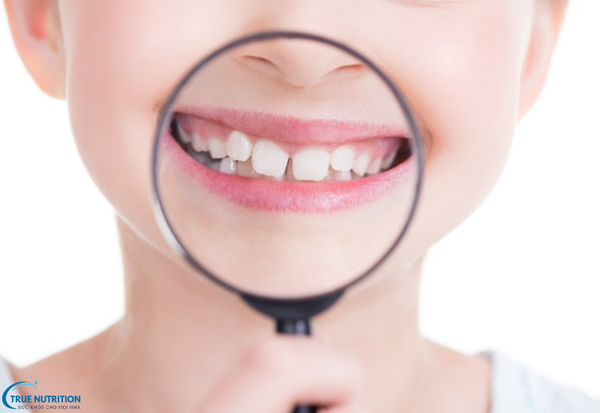 Bệnh Răng Lệch Có Thể Điều Trị Như Thế Nào? Giải Pháp Và Cách Khắc Phục