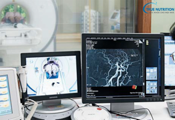 Thiếu Máu Não Thoáng Qua: Hiểm họa tiềm ẩn và cách điều trị tốt nhất