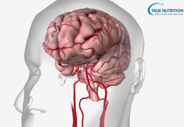Thiếu Máu Não Thoáng Qua: Hiểm họa tiềm ẩn và cách điều trị tốt nhất