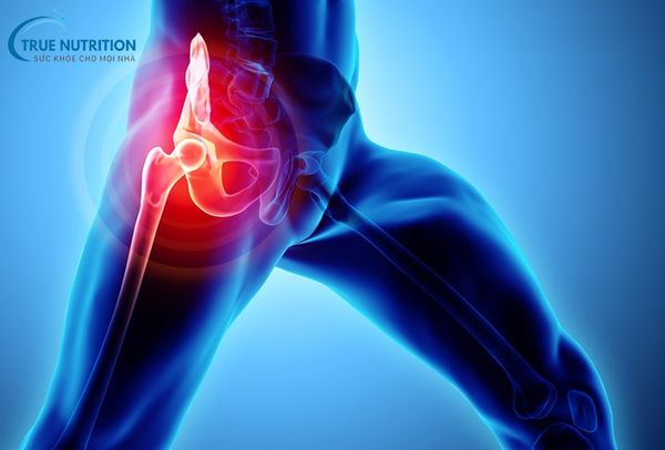 thoái hóa khớp háng