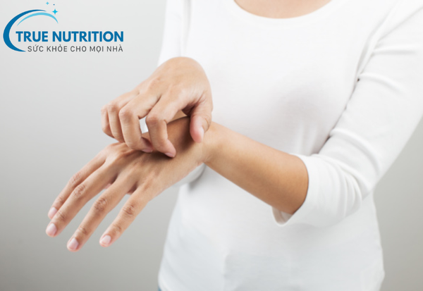 Tiểu Đường Có Bị Ngứa Không? Nguyên Nhân Bất Ngờ Và Cách Xử Lý Hiệu Quả