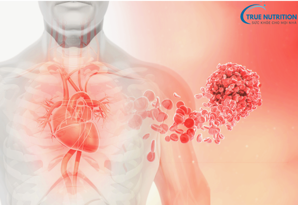 Bệnh Tim Mạch: Những Điều Cần Biết Để Bảo Vệ Sức Khỏe Tim
