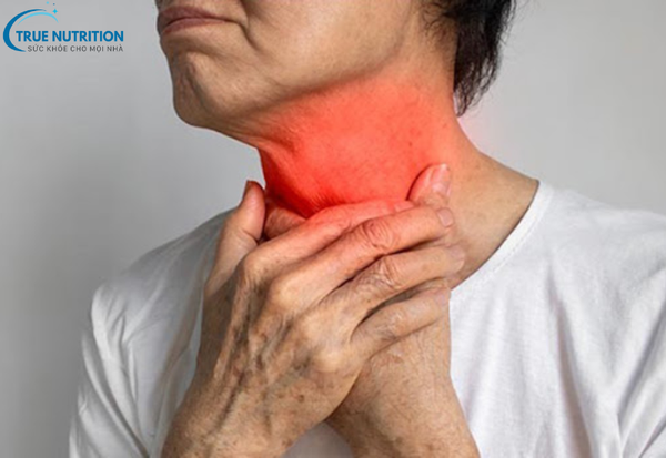 Trào Ngược Dạ Dày Thực Quản: Nhận Biết và Kiểm Soát Bệnh Từ A đến Z