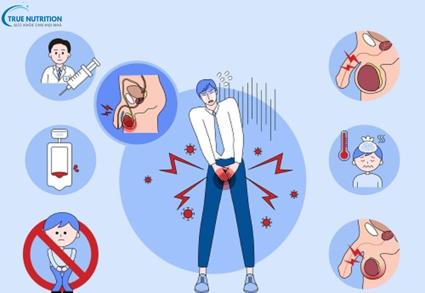 Cách Chữa Bệnh Viêm Tinh Hoàn: Điều Trị Sớm Để Bảo Vệ Sức Khỏe Sinh Sản