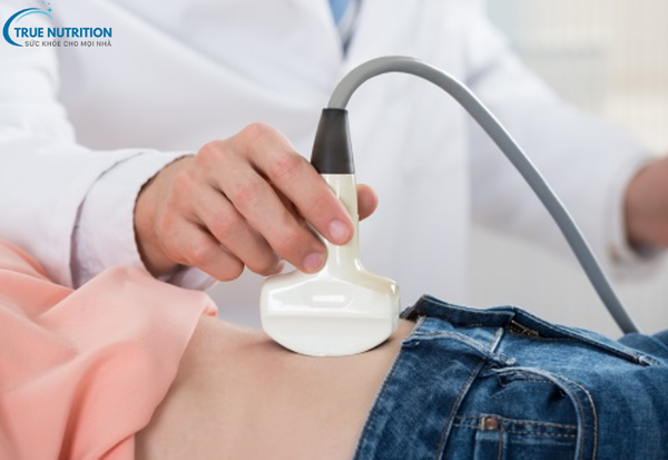 Bệnh U Nang Buồng Trứng: Cách Phát Hiện Sớm Và Giảm Nguy Cơ Biến Chứng