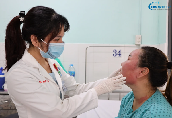 Có Nên Peel Da Không? Tất Cả Những Điều Bạn Cần Biết Trước Khi Làm