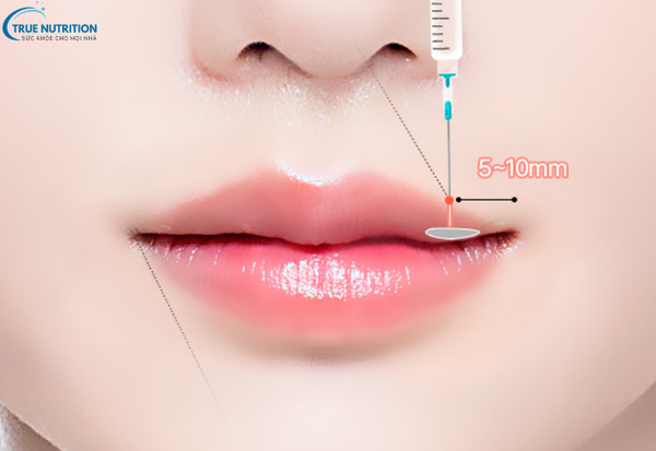 Tạo Hình Môi Có Đau Không? Những Điều Cần Biết Trước Khi Thẩm Mỹ