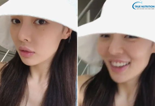 Tạo Hình Môi Có Đau Không? Những Điều Cần Biết Trước Khi Thẩm Mỹ