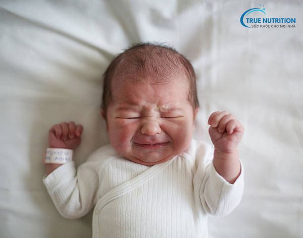 Hình ảnh rốn trẻ sơ sinh bị nhiễm trùng: Nhận biết, điều trị và phòng ngừa