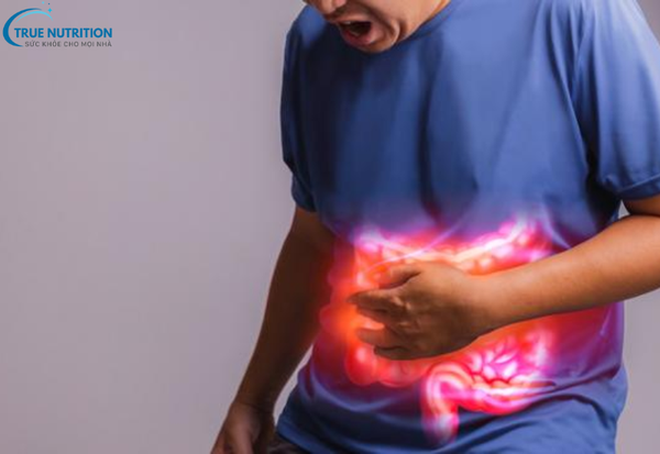 Ung Thư Đại Trực Tràng:&nbsp; Phát Hiện Sớm Và Điều Trị Kịp Thời