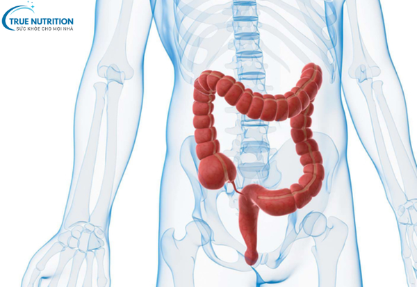 Ung Thư Đại Trực Tràng:&nbsp; Phát Hiện Sớm Và Điều Trị Kịp Thời