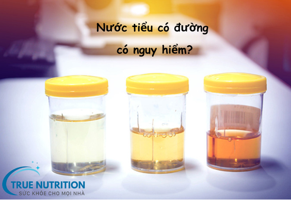 Nước Tiểu Có Đường Có Nguy Hiểm Không? Tìm Hiểu Nguyên Nhân Và Biện Pháp Bảo Vệ Sức Khỏe!