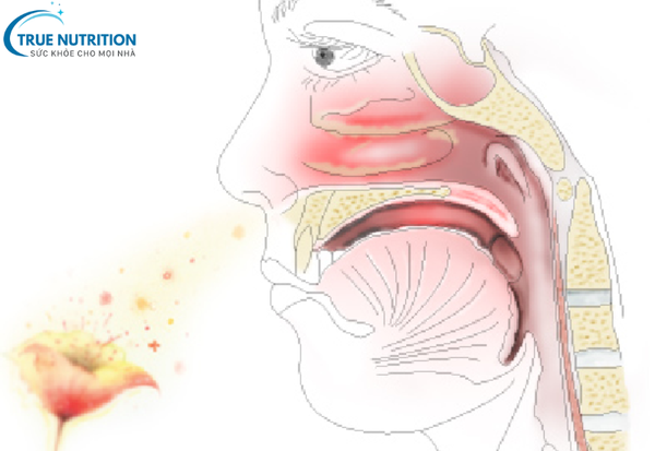 Viêm Mũi Dị Ứng: Bí Quyết Giảm Triệu Chứng Và Tăng Cường Đề Kháng