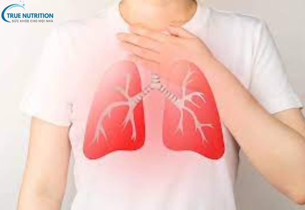 Viêm Phế Quản: Nguyên Nhân, Triệu Chứng và Cách Phòng Ngừa Hiệu Quả