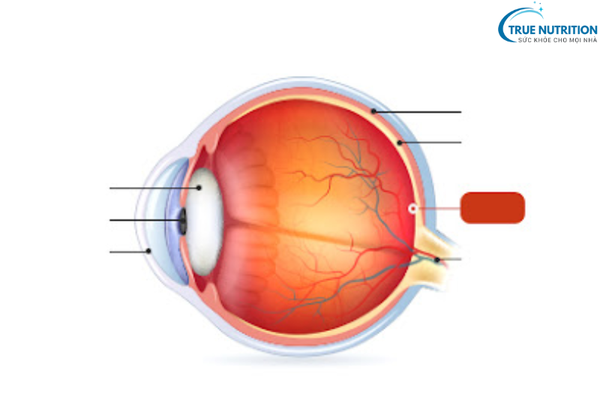 Bệnh Võng Mạc Tiểu Đường – Mối Nguy Hiểm Đối Với Thị Lực