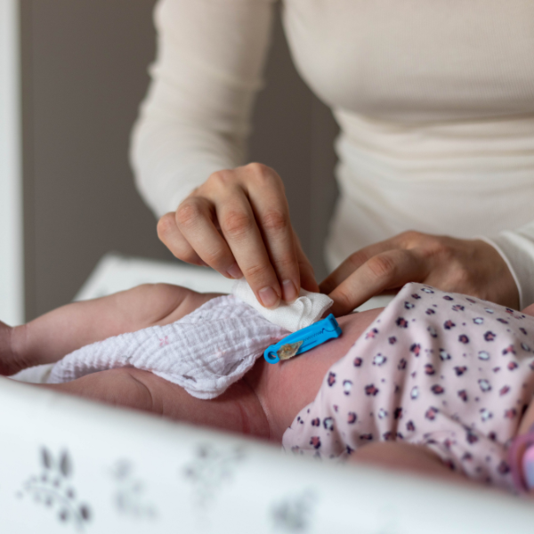 CHĂM SÓC RỐN CHO TRẺ SƠ SINH ĐÚNG CÁCH