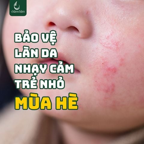 TINH DẦU TRÀM CHO BÉ MÙA HÈ – DỊU DA, CHỐNG MUỖI, BẢO VỆ SỨC KHOẺ