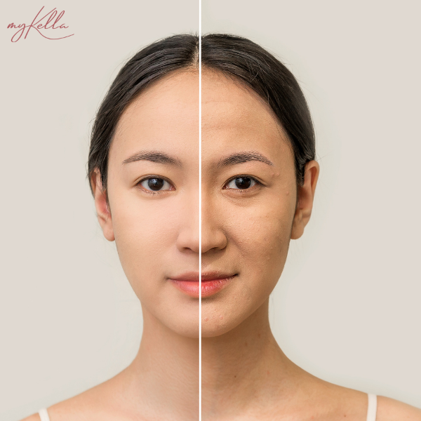 Kem chống nắng làm chậm lão hóa