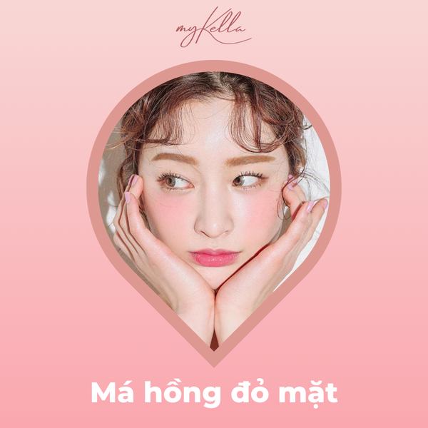 Má hồng “đỏ mặt”