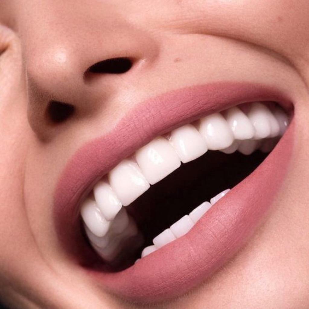 Bảo vệ răng tự nhiên - Một trong những khoản đầu tư quan trọng nhất của cuộc đời