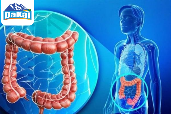 Hội chứng ruột kích thích (IBS): Nguyên nhân và triệu chứng bệnh