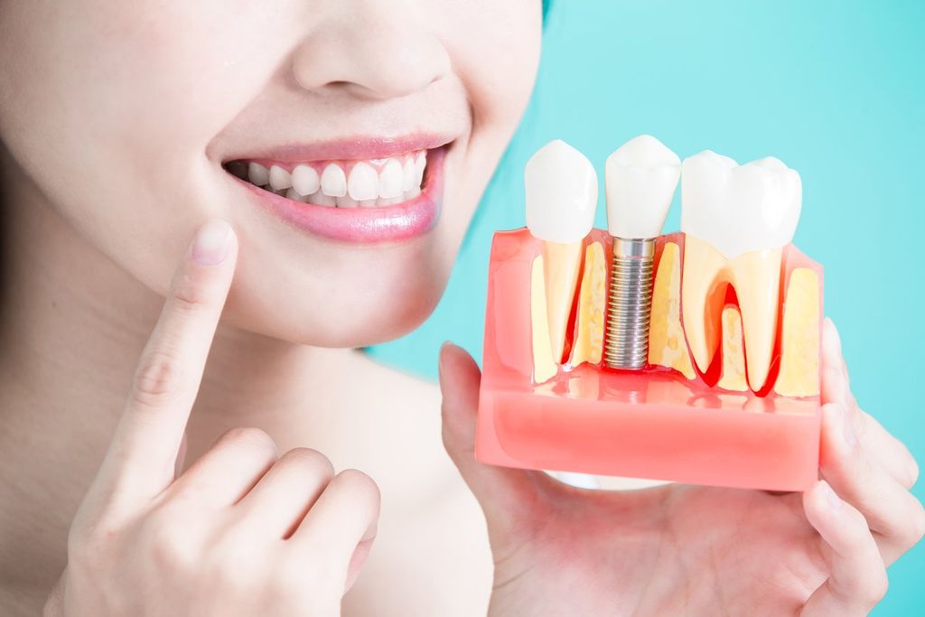 Cách chăm sóc implant sau khi phẫu thuật: Hướng dẫn chi tiết