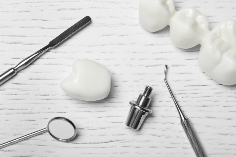 Mua Implant Giá Tốt Chính Hãng Tại Nghệ An