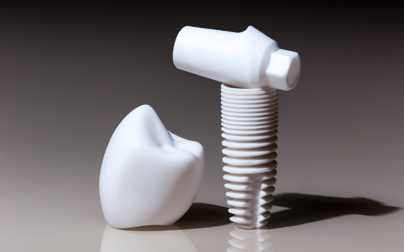 tim dia chi mua implant uy tin tai quan 5 o dau