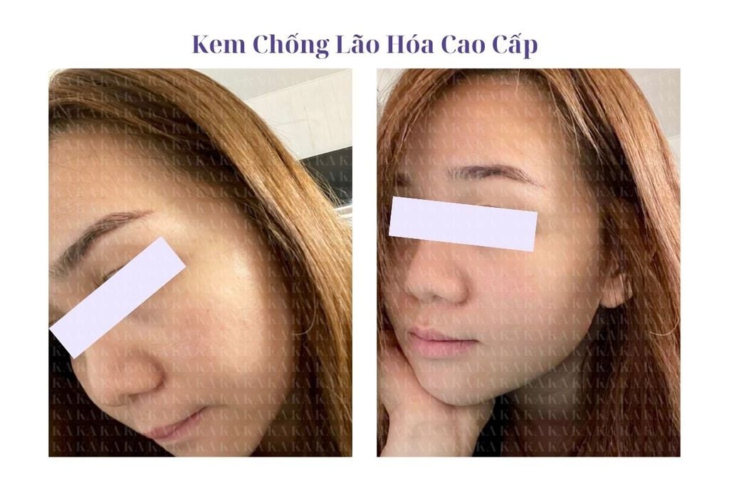 Phản hồi Bộ Chống Lão Hóa Da Cao Cấp KA GCG
