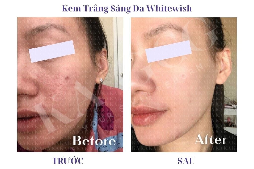 Phản hồi Kem Trắng Sáng Da Whitewish KA GCG