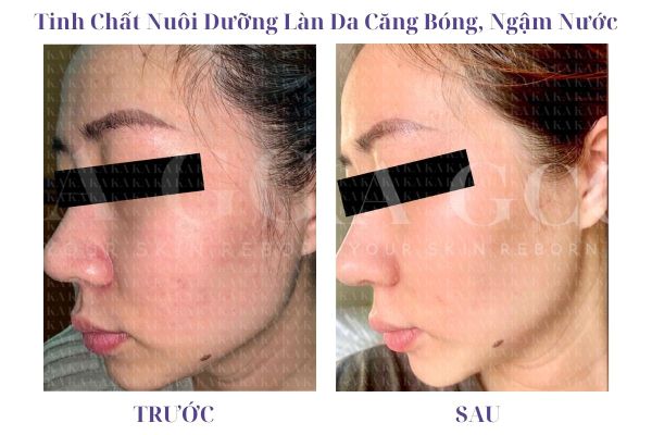 Phản hồi Tinh Chất Nuôi Dưỡng Làn Da Căng Bóng, Ngậm Nước KA GCG
