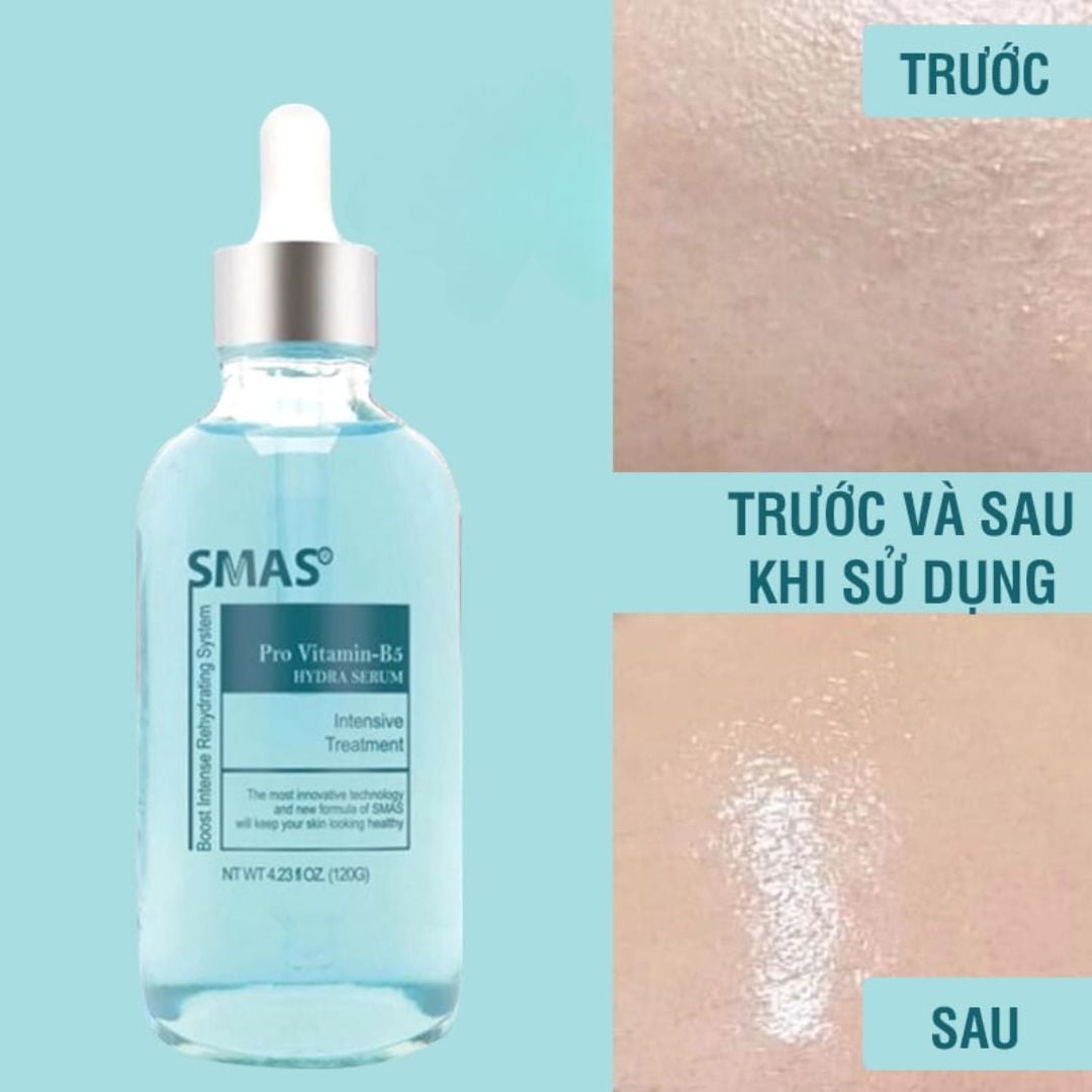 Serum Smas Pro Vitamin B5 Hydra Serum 120ml & Tinh Chất Cấp Ẩm SMAS HA – HT Beauty